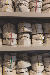 Dental gypsum models of jaws in dentist's office.