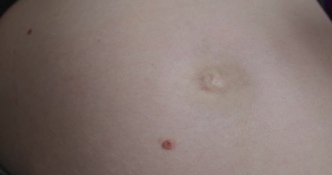 pregnant woman massages belly with oil