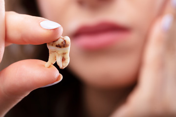 Woman Holding Decay Tooth