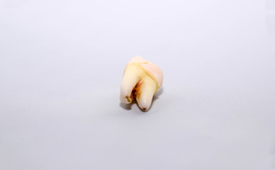 Zahn, Weisheitszahn, Zahnarzt, Schmerzen, draußen, gezogen, Medizin, von unten © mkstudio001