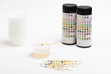 A setup for a urine test in a medical office with bottle container and an array of reagent strips along with sample urine in plastic containers set on white tabletop counter.