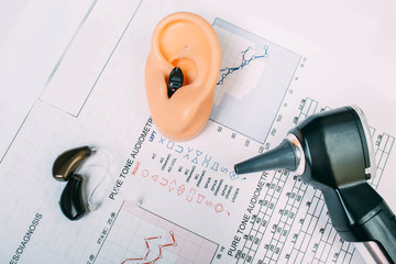 Hearing test concept. Result of hearing exam - audiogram, hearing aids and otoscope on the table, view from above. © Peakstock