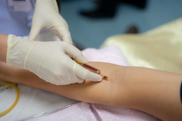 Intravenous  injection  With a syringe