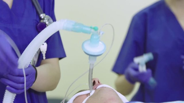 Anesthesiologist connects breathing circuit with a patient's  endotracheal tube   during the surgery (4K, 25fps)