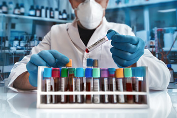 Technician of health holding blood tube for analytical in the clinical laboratory / doctor working with blood sample tube in hematology lab