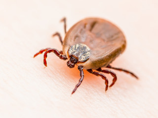 Encephalitis Virus or Lyme Disease Infected Dermacentor Tick Arachnid Insect on Skin Macro