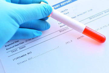 Laboratory result of vitamin B12 test with blood sample tube
