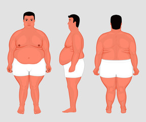 Vector illustration. Front, back, side views of naked man in full growth in underwear. For advertising of cosmetic plastic procedures, stomach shunting, bypass, diet, medical publications
