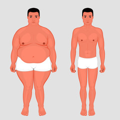 Vector illustration body weight loss in a European man from obesity to normal. Front view. For advertising of cosmetic plastic procedures, stomach shunting, diet; medical publications