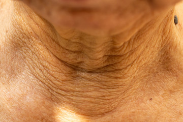 Senior woman's wrinkled neck, Black mole, Medicine, Close up & Macro shot, Selective focus, Body part, Healthcare concept