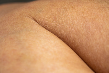 Fototapeta premium Woman's dry skin on calf of the leg, Close up & Macro shot, Selective focus, Asian skin tone, Healthcare concept