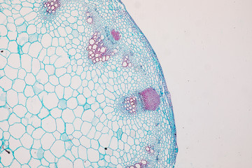 Cross-section Dicot, Monocot and Root of Plant Stem under the microscope for classroom education. 