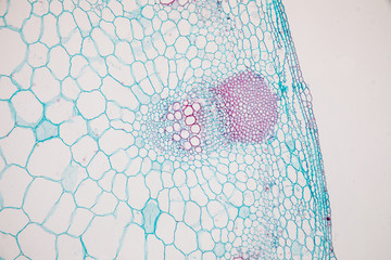 Cross-section Dicot, Monocot and Root of Plant Stem under the microscope for classroom education. 