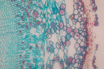 Cross-section Dicot, Monocot and Root of Plant Stem under the microscope for classroom education. 