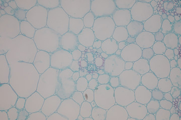 Fototapeta premium Cross-section Dicot, Monocot and Root of Plant Stem under the microscope for classroom education. 