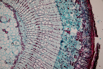 Cross-section Dicot, Monocot and Root of Plant Stem under the microscope for classroom education. 