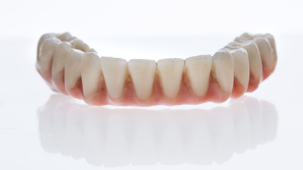 Dental prosthesis lower jaw high quality