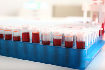 Test tubes with blood samples on table in laboratory