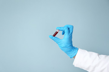Hand of laboratory assistant holding test tube with blood sample on color background