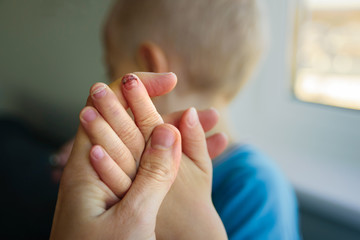 Baby with broken nail
