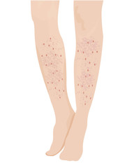 Psoriasis on female legs 