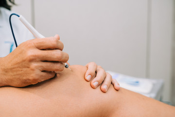 Electroacupunture dry needling needle connecting machine to needles used by acupunturist on patient for acupunture guided by EPI Intratissue Percutaneous Electrolisis.