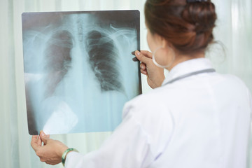 Rear view of female lung specialist checking chest x-ray of patient