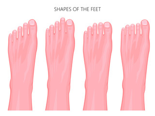 Most common types of human forefoot shapes with different variations of relative length of the toes. Vector illustration isolated on white background.