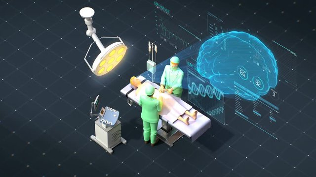 Surgery operating room vector illustration of doctor and patients with hologram brain, future medical technology. 4k animation.