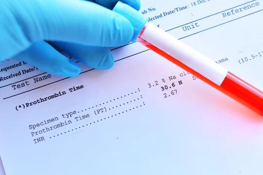 Abnormal high result of prothrombin time test with blood sample tube