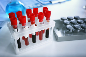 Test tubes with blood samples on table in laboratory