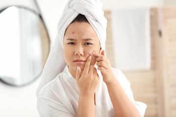 Portrait of young Asian woman with acne problem squishing pimples in bathroom