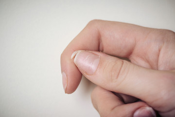 Close-up of brittle nails. A broken nail on your finger.