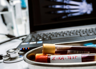 Test of zika virus, blood sample in a hospital, conceptual image