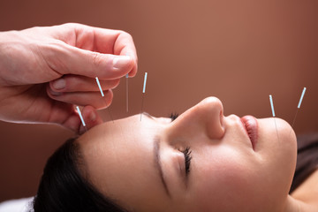 Woman Receiving Acupuncture Treatment On Her Face - obrazy, fototapety, plakaty