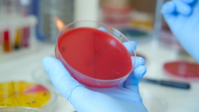 Growth of a colony of microbes and pathogenic fungi in a Petri dish in a bacteriological laboratory