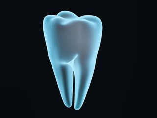Dental implant dentist, tooth layout, plastics, man, teeth, treatment. 3D