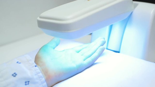 hands of a patient with psoriasis close-up under an ultraviolet lamp. Light therapy, phototherapy