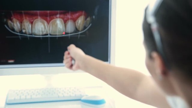 The dentist displays a picture of the patient's teeth on the monitor. Dental prosthetics
