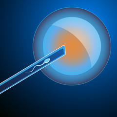 Artificial insemination. The fertilized egg, washed, injected sperm, uterus, womb, syringe. In vitro fertilisation. Artificial insemination element.