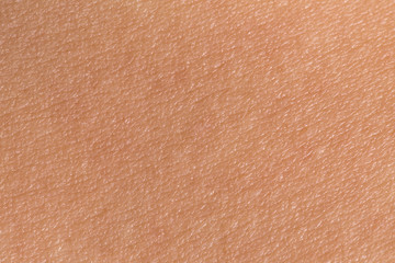 Woman's skin
