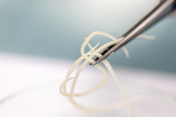 Ascariasis is a disease caused by the parasitic roundworm Ascaris lumbricoides for education in laboratories.