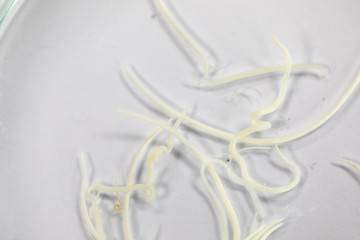 Ascariasis is a disease caused by the parasitic roundworm Ascaris lumbricoides for education in...