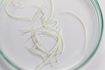 Ascariasis is a disease caused by the parasitic roundworm Ascaris lumbricoides for education in...
