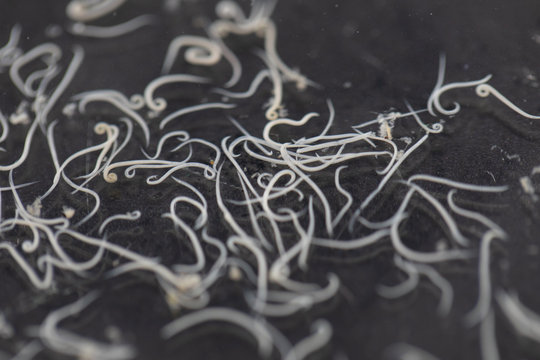 Ascariasis is a disease caused by the parasitic roundworm Ascaris lumbricoides for education in laboratories.