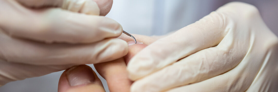 Closeup view of professional medical pedicurist removing cuticle