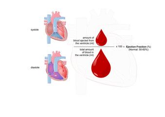 ejection fraction: measure of the heart functionality - obrazy, fototapety, plakaty