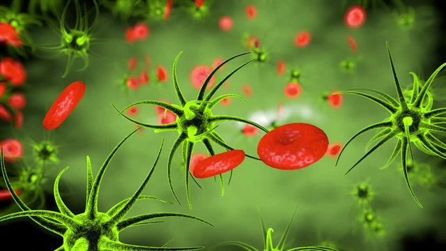 Septisch VideoFootage Durchsuchen 177 HDArchivvideos und Footage