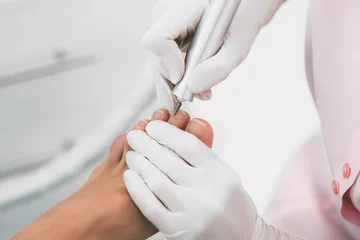 Foto op Plexiglas Podolog verwijdert de nagelriem op de nagels met behulp van hardware. © Peakstock