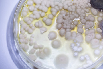 Colony characteristic of Actinomyces, Bacteria, yeast and Mold on selective media from soil samples for study in laboratory microbiology.